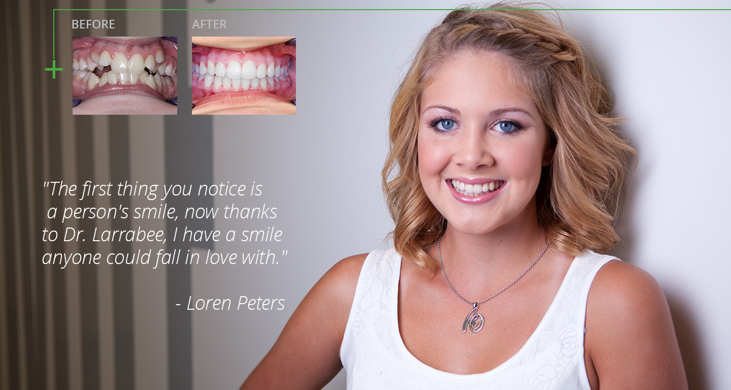 advanced-orthodontics-braces-before-and-after