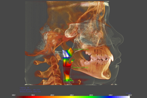 advanced-orthodontics-technology