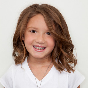 advanced-orthodontics-child-treatment2