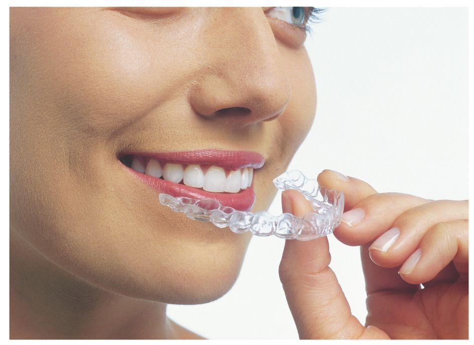 Photo of teen using invisalign for orthodontic treatment