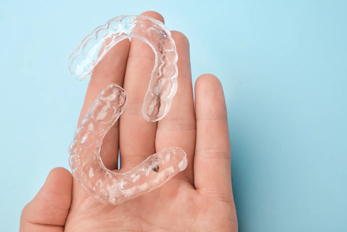 Clear Aligner